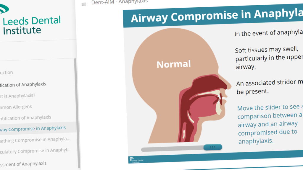 Screenshot of DentAIM digital learning.